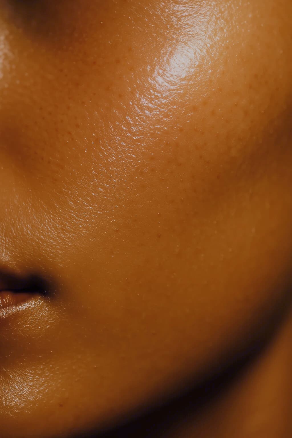 Botox treatment close-up